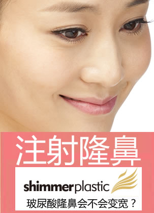 玻尿酸隆鼻会不会变宽? 济南旭美整形院长王彪教授实话告诉你