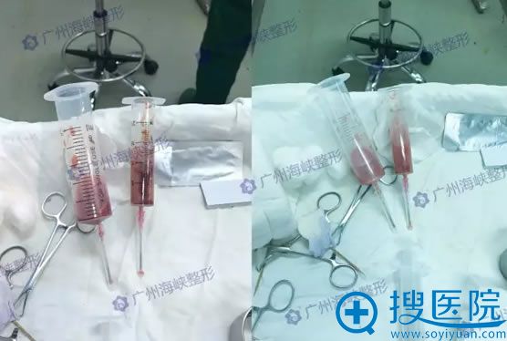 �沿������ȡ��������