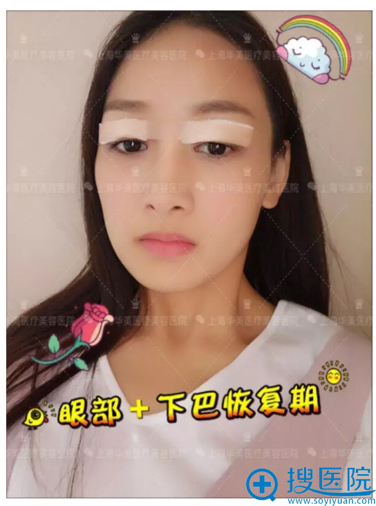 ˫��Ƥ����ָ���Ч����