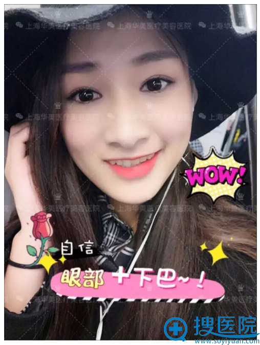 ˫��Ƥ�������ڵ����ӣ�����������Ů