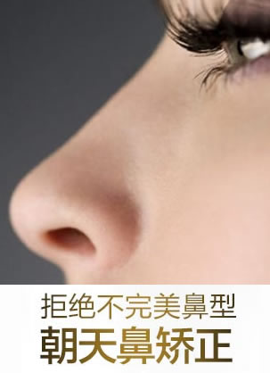 朝天鼻矫正整形价格是多少钱?北京雅韵20800元告别“猪”鼻