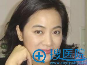 魏红_<!--<i data=20240710 data-id=12791></i>-->医疗美容门诊部 魏红_<!--<i data=20240710 data-id=12791></i>-->医疗美容门诊部