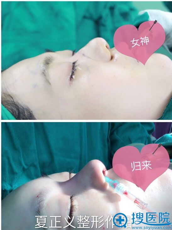 北京米扬丽格夏正义做鼻子效果 北京米扬丽格夏正义做鼻子效果