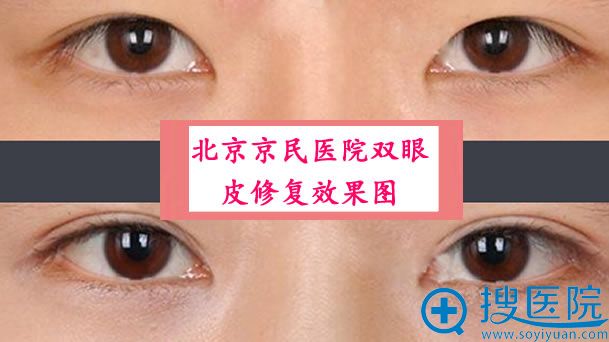��������ҽԺ˫��Ƥ�޸�<span style=