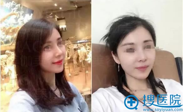 ����֬�����̫��Ѩ���ṵ���Ǵ������°��ȶ���Ч��