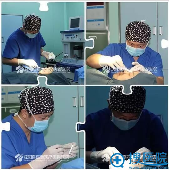 王志涛根据我的实际状况量身打造鼻假体 王志涛根据我的实际状况量身打造鼻假体