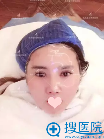 做了皮肤项目 做了皮肤项目