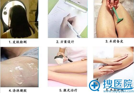 深圳仁安雅冰点无痛脱毛精细化流程 深圳仁安雅冰点无痛脱毛精细化流程