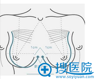 深V乳沟技术 深V乳沟技术