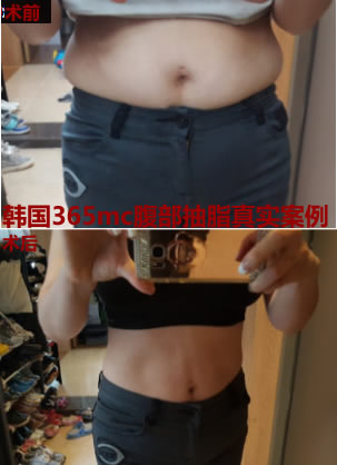 ����365MC��֬ҽԺ������֬���˰��� 3���º����ұ��ħ������