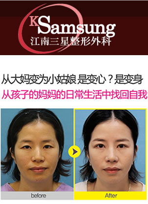 韩国江南三星整形外科朴英进院长眼鼻整形案例 大妈逆袭变少女