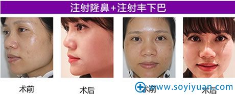 �麣����ע��¡��ǰ��Ա���