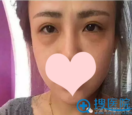 ��ǰ��Ƭ