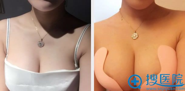 ����֬��ע��¡�������15��