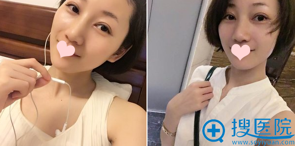 ���컪���δ�������˫��Ƥ¡�ǰ�������һ����Ч��ͼ