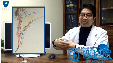 王维主任讲述双眼皮如何窄变宽 王维主任讲述双眼皮如何窄变宽