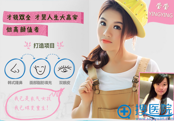 海口红妆学生隆鼻+双眼皮+面部脂肪填充案例 海口红妆学生隆鼻+双眼皮+面部脂肪填充案例