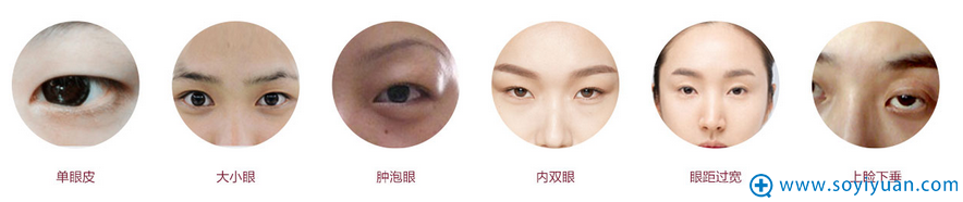 各种类型的眼睛 各种类型的眼睛