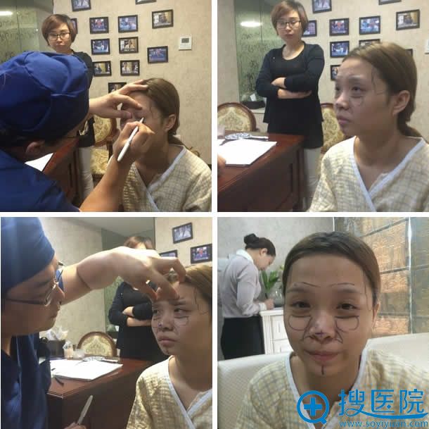武汉顶吉整形金亨俊设计鼻综合整形方案 武汉顶吉整形金亨俊设计鼻综合整形方案