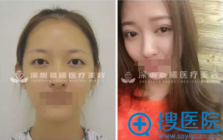�촺������˫��Ƥ����