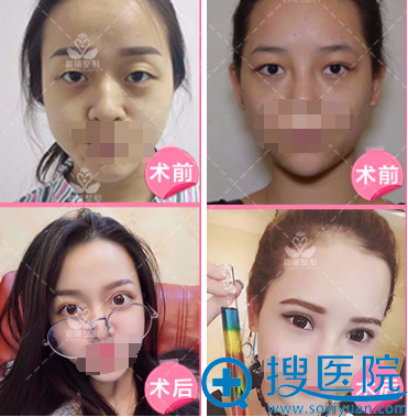 �촺�޺�ʽ˫��Ƥ����
