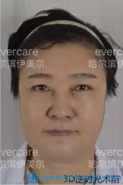 ���������������γ�ά���沿�ߵ��������� �����������İ���