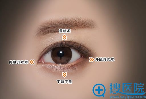 北京克莱美舍张冰洁双眼皮案例 北京克莱美舍张冰洁双眼皮案例