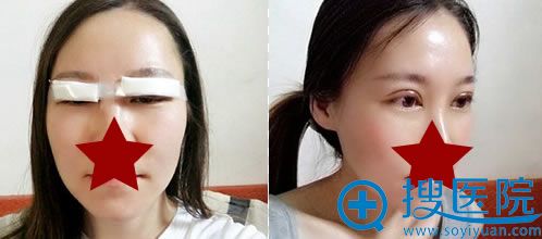 ���ٶ�Ժ����˫��Ƥ��������Ƭ