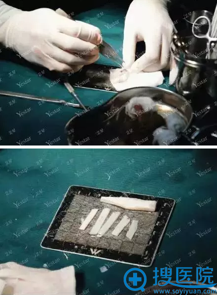 隆鼻假体雕刻 隆鼻假体雕刻