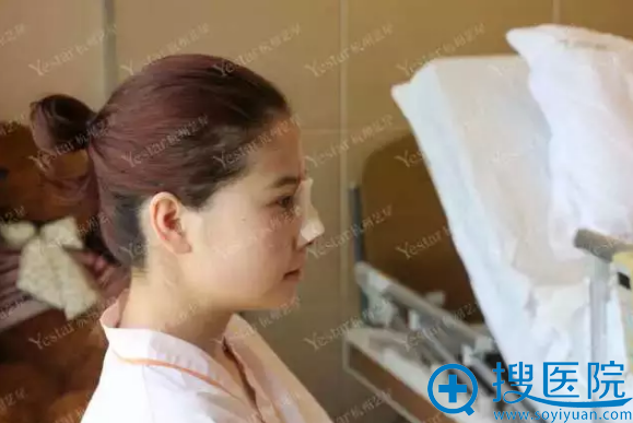隆鼻术后第三天恢复照 隆鼻术后第三天恢复照