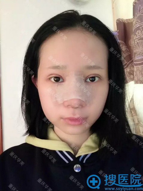 ˫��Ƥ����2��ָ�Ч��