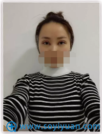术后天,眼睛肿胀 术后天,眼睛肿胀