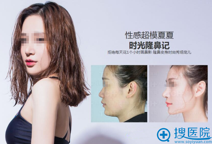 隆鼻整形真人秀 隆鼻整形真人秀