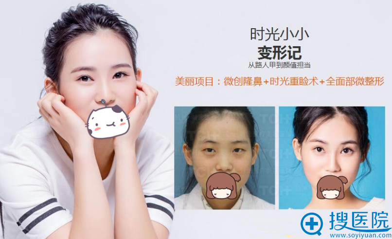 微创隆鼻+时光重睑术+全面部微整 微创隆鼻+时光重睑术+全面部微整