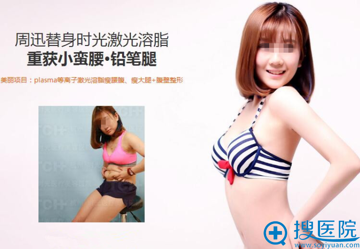 plasma等离子激光溶脂瘦腰腹、瘦大腿+腹壁整形 plasma等离子激光溶脂瘦腰腹、瘦大腿+腹壁整形