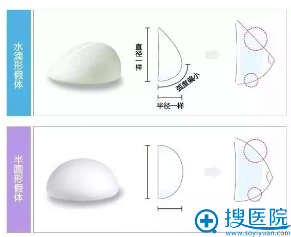 不同形态的假体 不同形态的假体