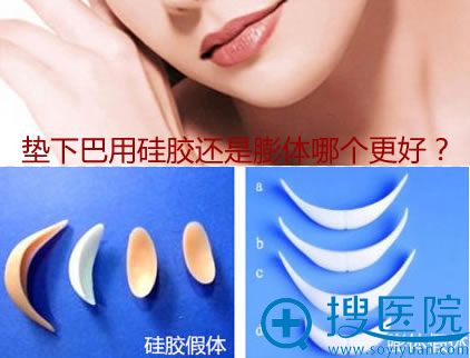 垫下巴用硅胶好还是膨体好 垫下巴用硅胶好还是膨体好