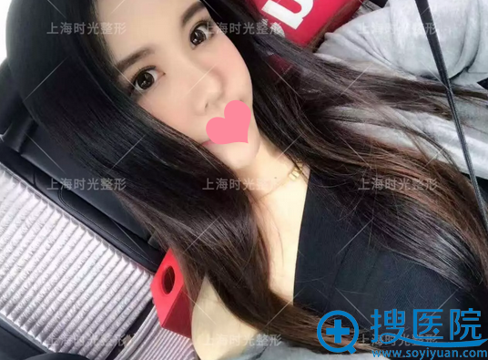 【真人秀】在上海时光打完玻尿酸做完皮秒的她,如今美成了这样
