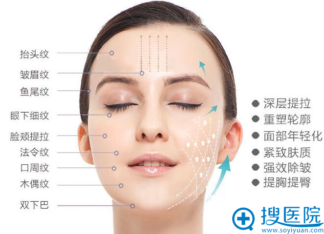 4D逆龄焕颜线雕术 4D逆龄焕颜线雕术