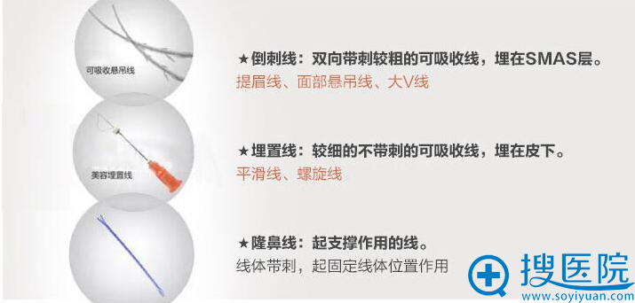 线雕分析 线雕分析