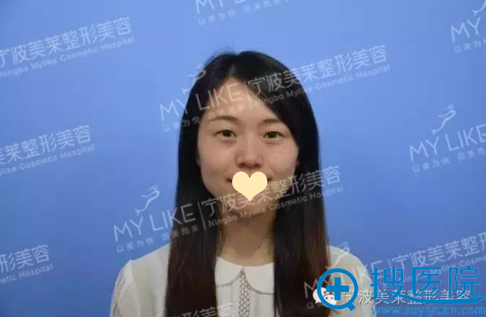 双眼皮术前照 双眼皮术前照