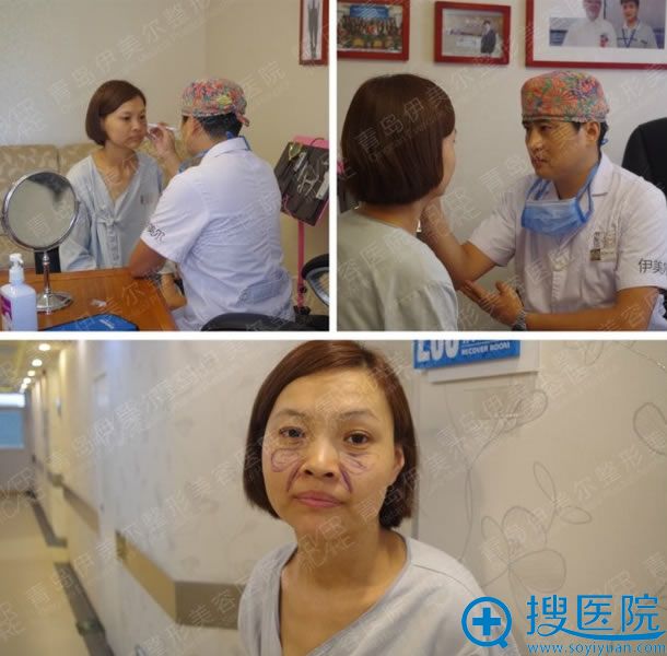伊美尔外路祛眼袋手术方案设计 伊美尔外路祛眼袋手术方案设计