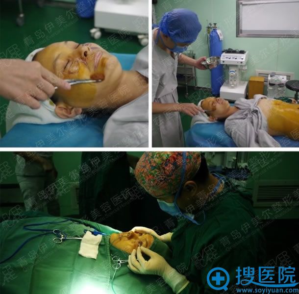 <!--<i data=20240710 data-id=12077></i>-->手术前消毒准备过程 <!--<i data=20240710 data-id=12077></i>-->手术前消毒准备过程