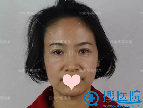 ��Ȼ�Ѿ�40�굫�һ���ȥ���������������������沿�ߵ���������