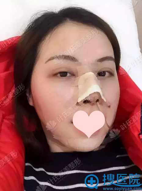 ����¡�������������