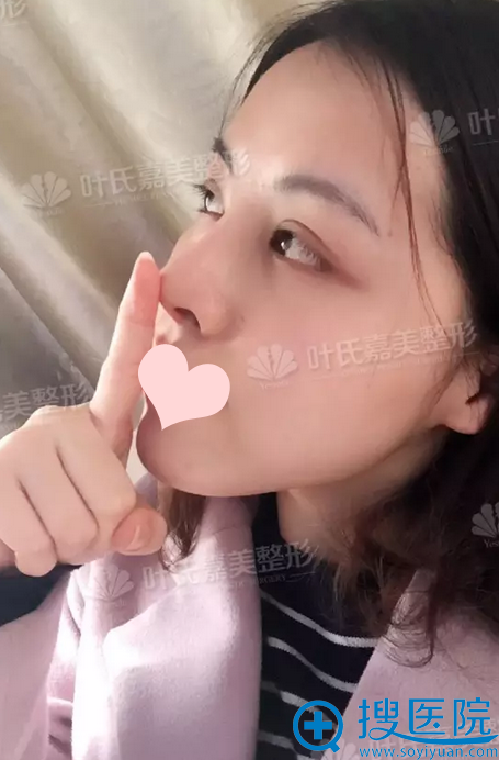 ¡��12���ˣ��ָ��ĺܺã�����������ɱ��