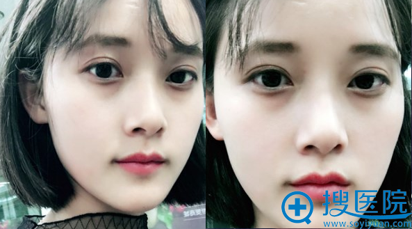 ˫��Ƥ����������������