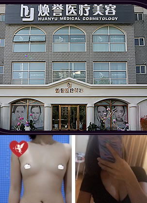 北京焕誉医疗美容价格贵吗?刚找朱昊做自体脂肪隆胸12800