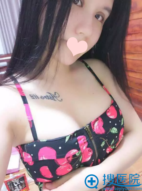 隆胸术后是后感柔软有弹性 隆胸术后是后感柔软有弹性