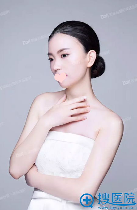 双眼皮术后一个月写真 双眼皮术后一个月写真